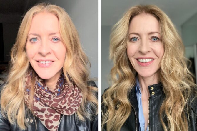 Alice Mris before and after