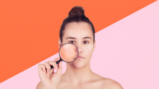 5 tweakment and skincare treatments to treat acne