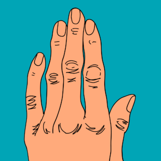 Fat or Muscle Loss In Hands