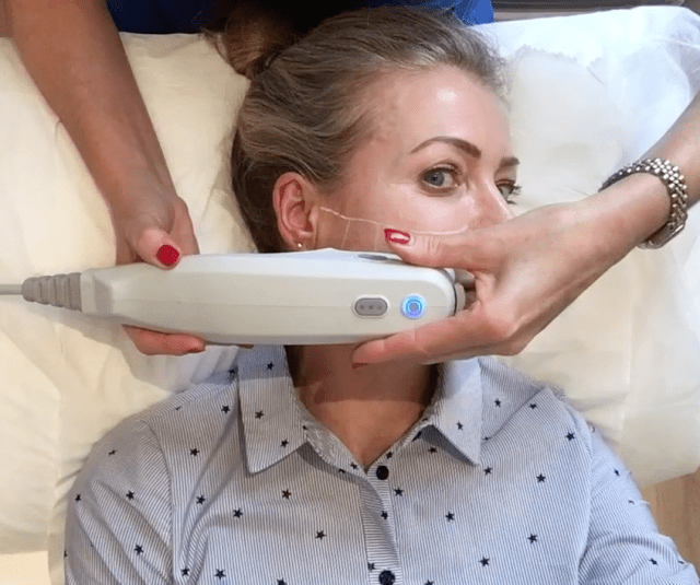 focused ultrasound 1 ultherapy