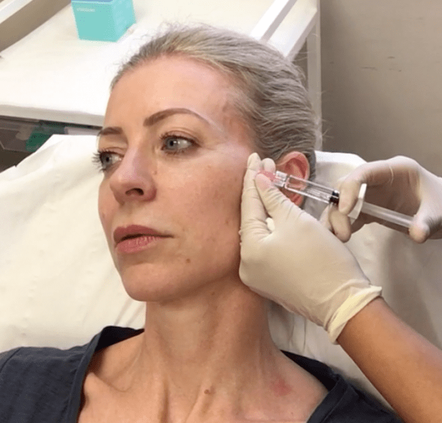 Skin conditioning injections