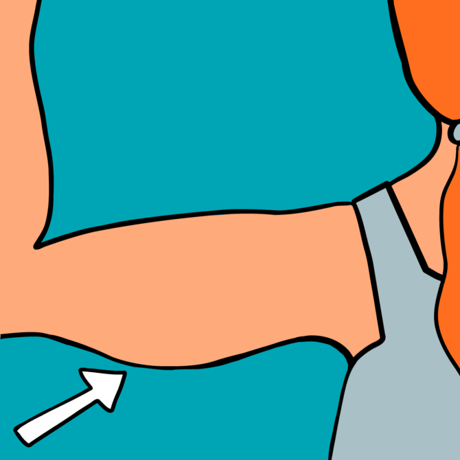 Slack skin on inner arms